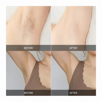 SmoothBeam - Full-Body Smoothness, Zero Irritation